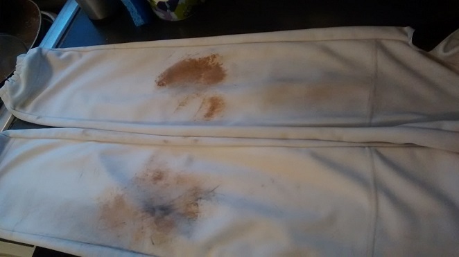 Best Method To Clean White Baseball Pants